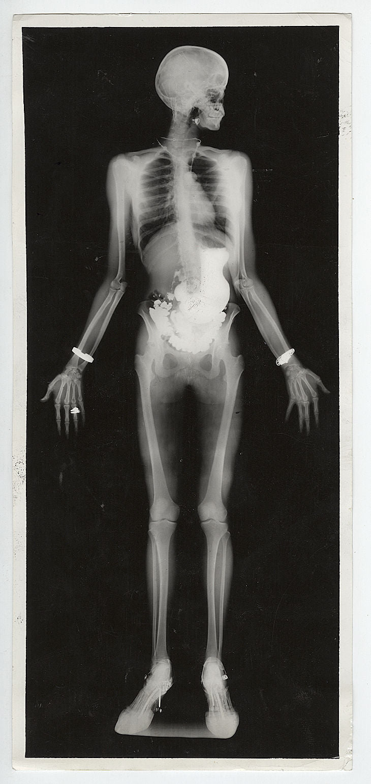 [X-Ray] Transparent Lady (Eastman Kodak x-ray research lab), 1934